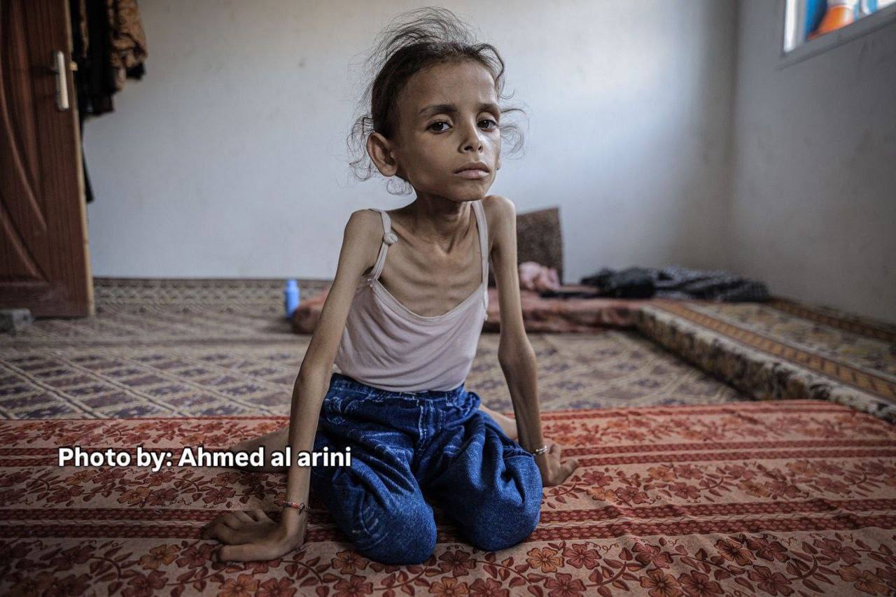 Friday, August 1, 2025 – The Gaza Strip inline image