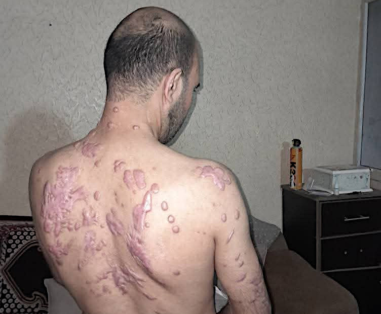 Monday, February 24, 2025 – The Gaza Strip cover image